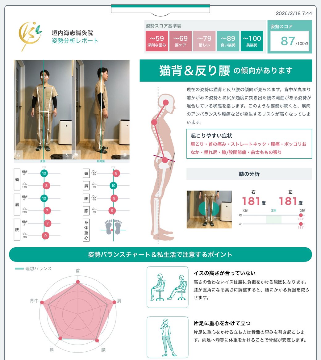 姿勢分析レポートの実例。姿勢スコア、猫背・反り腰などの傾向、頭・肩・腰のゆがみ数値、姿勢バランスチャート、生活で気をつけるポイントが1枚にまとまっている